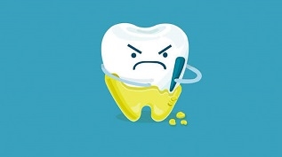 【口腔健康】居然这么多人有牙结石的烦恼